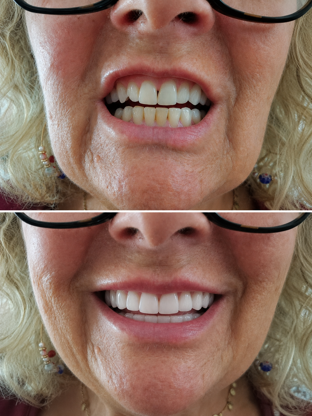 Praxis Millworks restorative result